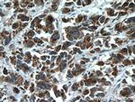 BAD Antibody in Immunohistochemistry (Paraffin) (IHC (P))