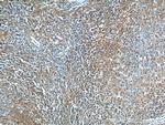 BAD Antibody in Immunohistochemistry (Paraffin) (IHC (P))