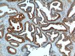 BAD Antibody in Immunohistochemistry (Paraffin) (IHC (P))