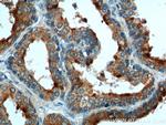 BAD Antibody in Immunohistochemistry (Paraffin) (IHC (P))