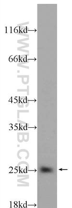 BAD Antibody in Western Blot (WB)