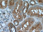 Caspase 2/p18 Antibody in Immunohistochemistry (Paraffin) (IHC (P))