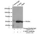 Caspase 2/p18 Antibody in Immunoprecipitation (IP)