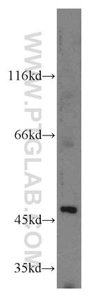 EIF4A3 Antibody in Western Blot (WB)
