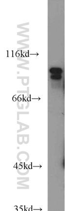 USP5 Antibody in Western Blot (WB)