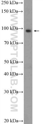 USP5 Antibody in Western Blot (WB)