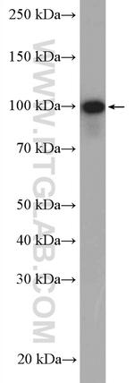 USP5 Antibody in Western Blot (WB)