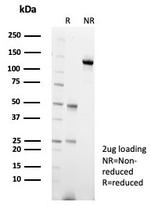CARM1 Antibody in SDS-PAGE (SDS-PAGE)