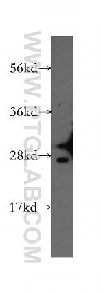 GSTA2 Antibody in Western Blot (WB)