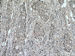 SURVIVIN Antibody in Immunohistochemistry (Paraffin) (IHC (P))