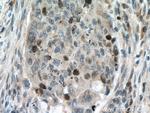 SURVIVIN Antibody in Immunohistochemistry (Paraffin) (IHC (P))