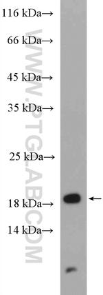 SURVIVIN Antibody in Western Blot (WB)