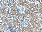 DDR1 Antibody in Immunohistochemistry (Paraffin) (IHC (P))