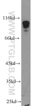 HNRNPUL1 Antibody in Western Blot (WB)