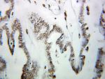 HNRNPUL1 Antibody in Immunohistochemistry (Paraffin) (IHC (P))