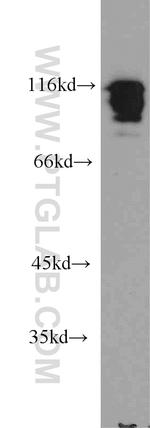 HNRNPUL1 Antibody in Western Blot (WB)