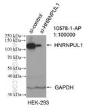 HNRNPUL1 Antibody in Western Blot (WB)