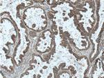 TRAPA/SSR1 Antibody in Immunohistochemistry (Paraffin) (IHC (P))