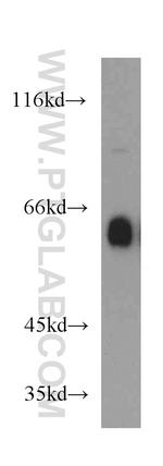 IA-2/PTPRN Antibody in Western Blot (WB)