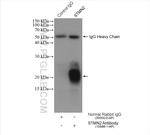 STMN2 Antibody in Immunoprecipitation (IP)