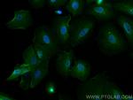 BAG3 Antibody in Immunocytochemistry (ICC/IF)