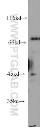 BAG3 Antibody in Western Blot (WB)