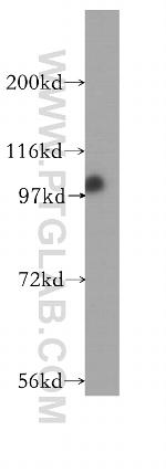 XAB2 Antibody in Western Blot (WB)