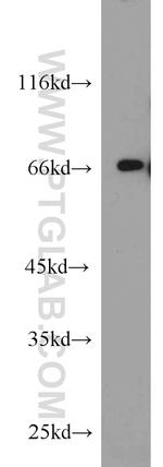 TDP1 Antibody in Western Blot (WB)