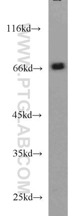 TDP1 Antibody in Western Blot (WB)