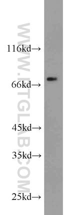 DPP3 Antibody in Western Blot (WB)