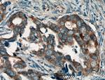 Hsc70 Antibody in Immunohistochemistry (Paraffin) (IHC (P))