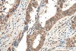 Hsc70 Antibody in Immunohistochemistry (Paraffin) (IHC (P))