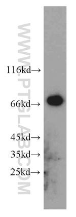 Hsc70 Antibody in Western Blot (WB)