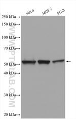 FKBP52 Antibody in Western Blot (WB)