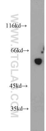 FKBP52 Antibody in Western Blot (WB)