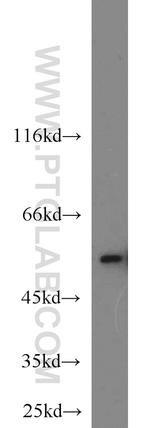 FKBP52 Antibody in Western Blot (WB)