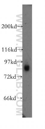 AGO2 Antibody in Western Blot (WB)