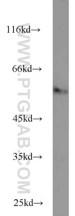 FBXO7 Antibody in Western Blot (WB)