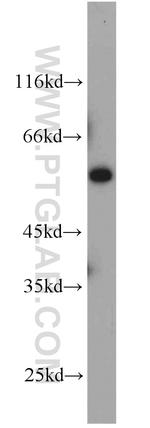 FBXO7 Antibody in Western Blot (WB)