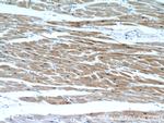 CSRP3 Antibody in Immunohistochemistry (Paraffin) (IHC (P))