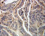 UBE2G2 Antibody in Immunohistochemistry (Paraffin) (IHC (P))