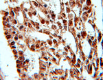 PRPF4 Antibody in Immunohistochemistry (Paraffin) (IHC (P))