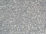 RHOA Antibody in Immunohistochemistry (Paraffin) (IHC (P))