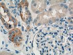 RHOA Antibody in Immunohistochemistry (Paraffin) (IHC (P))