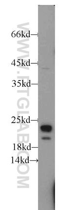 RHOA Antibody in Western Blot (WB)