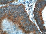 RHOA Antibody in Immunohistochemistry (Paraffin) (IHC (P))