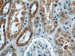 UQCRB Antibody in Immunohistochemistry (Paraffin) (IHC (P))