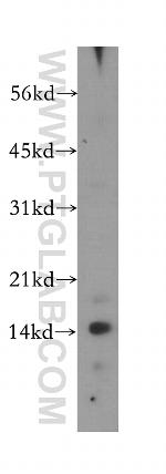 UQCRB Antibody in Western Blot (WB)