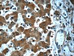 SND1 Antibody in Immunohistochemistry (Paraffin) (IHC (P))