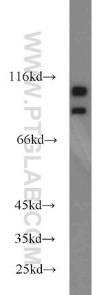 SND1 Antibody in Western Blot (WB)